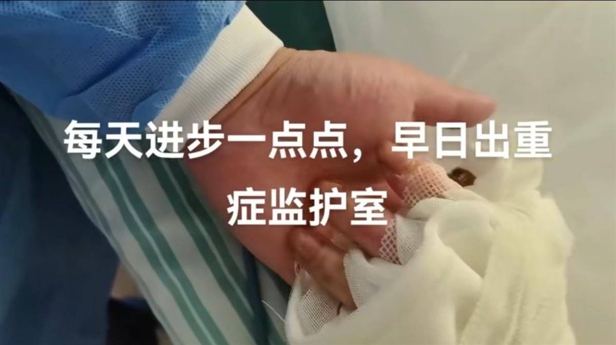 “烧伤妈妈”术后首次开口说话<strong></p>
<p>君融理财</strong>，称一辈子的苦都吃完了，其丈夫已开始带货，512件好物有497人跟买
