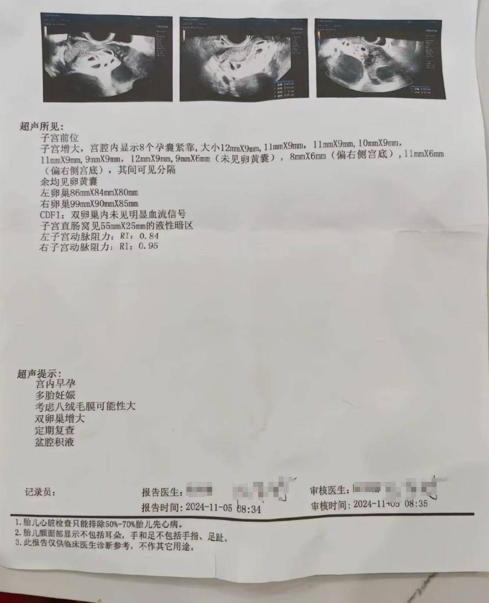 怀上9胞胎女子今日进行减胎手术：分两次进行<strong></p>
<p>理财产品排名</strong>，第一次减去四个胚胎，第二次减去三个