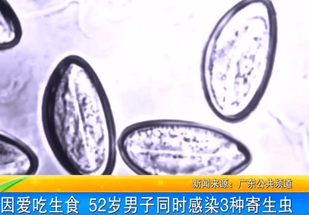 女子体内排出10米长绦虫<strong></p>
<p>理财目标</strong>！原是两年前旅游时吃了这种食物