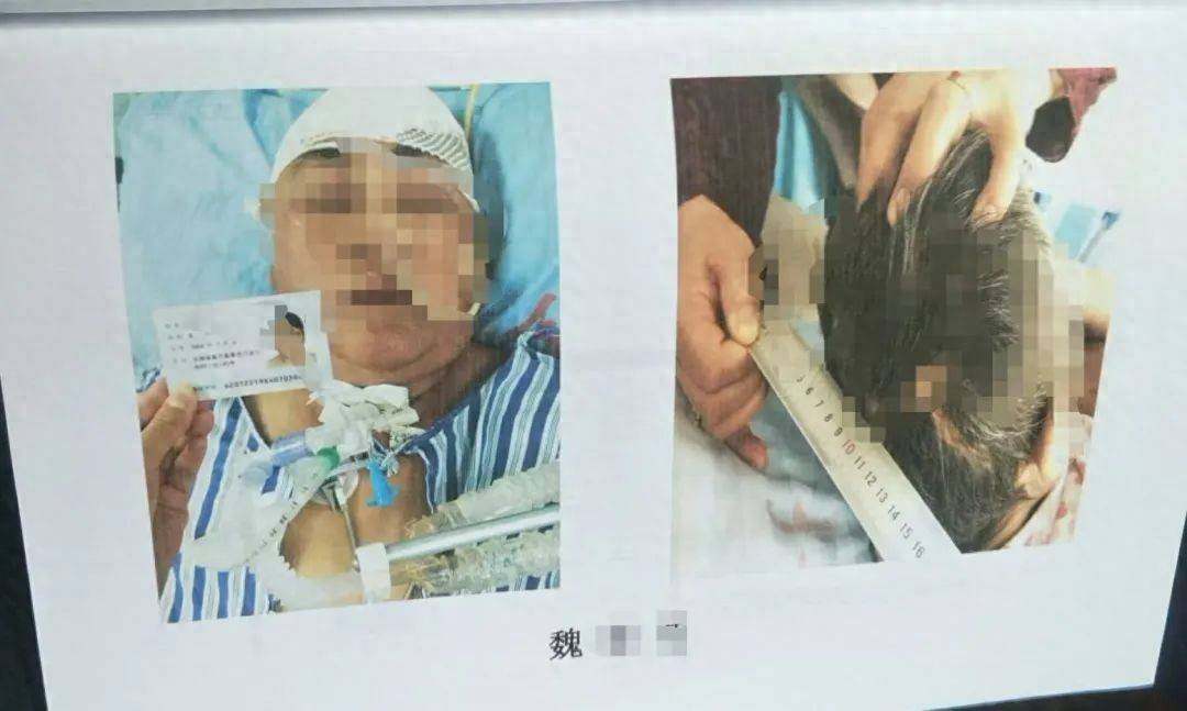 目睹母亲过马路被车撞<strong></p>
<p>理财翻译</strong>，27岁女子受惊吓5天后身亡