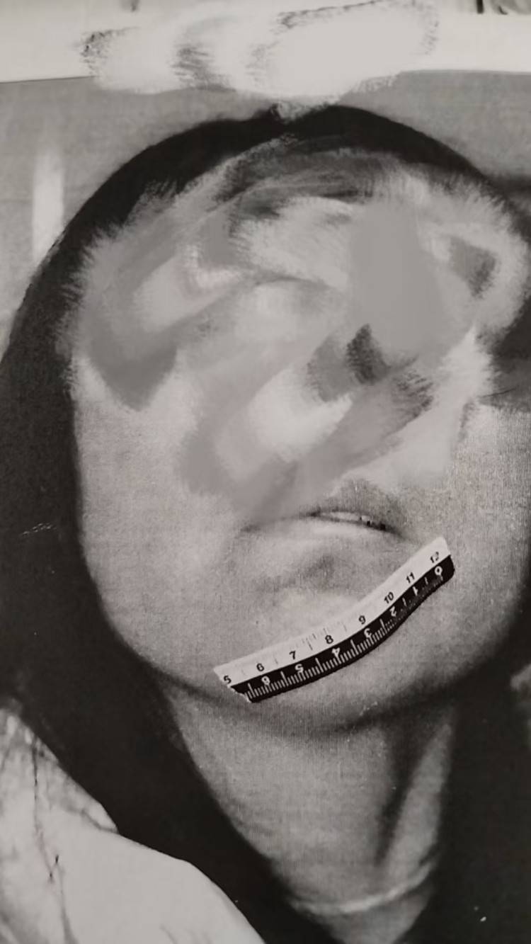男粉丝咬伤女主播后写条子：赔“十万元”还是赔“十5元”<strong></p>
<p>理财选择</strong>？