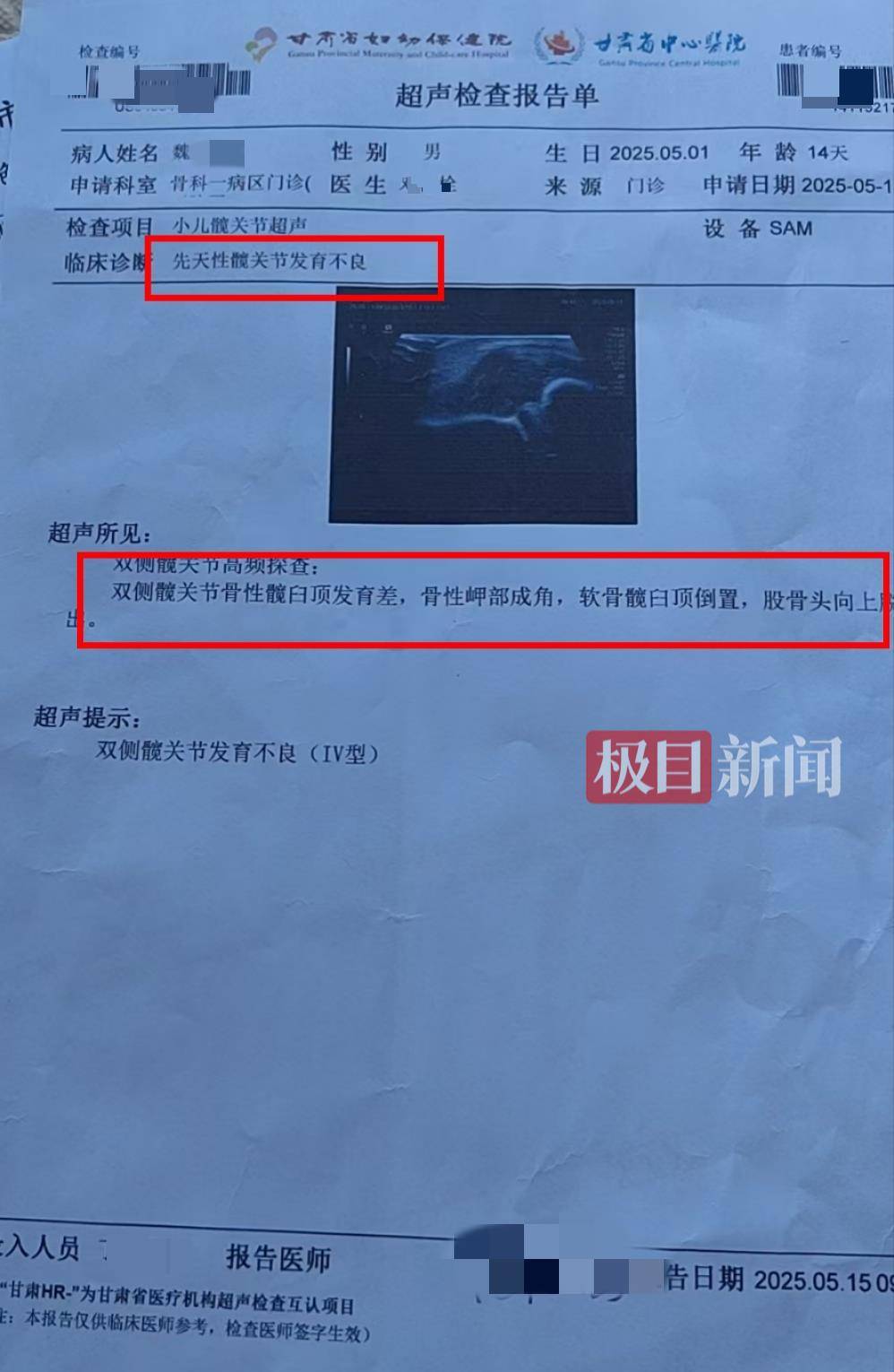 二胎出生查出先天性病症或落下残疾<strong></p>
<p>长期理财产品</strong>，残疾父母称医院产检漏检、未尽告知义务，医院及医调委回应