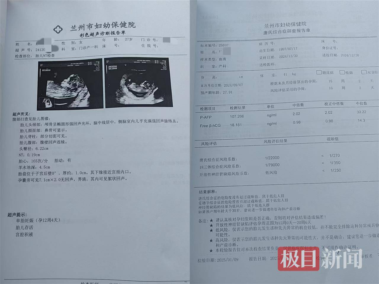 二胎出生查出先天性病症或落下残疾<strong></p>
<p>长期理财产品</strong>，残疾父母称医院产检漏检、未尽告知义务，医院及医调委回应