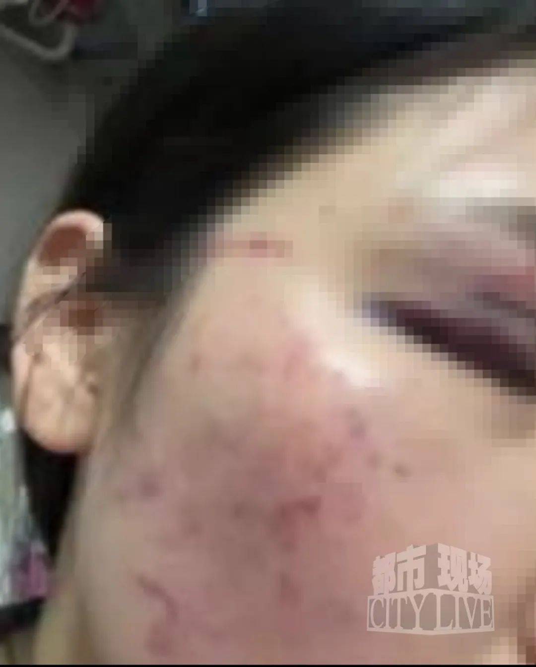 湖南衡阳29岁女子疑被男友施暴后从25楼跳下身亡 男友徐某此前还刺激说：“你放心<strong></p>
<p>理财风险低</strong>，她不会去死的”