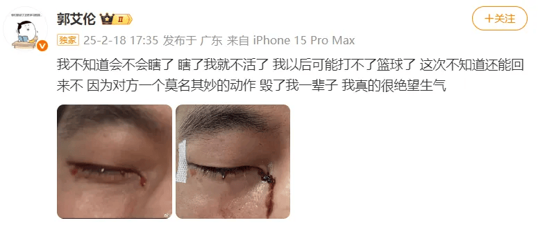 31岁郭艾伦直言想回国家队<strong></p>
<p>p2p理财安全吗</strong>，但应该没什么机会了，此前眼睛被队友误伤，缝了40多针