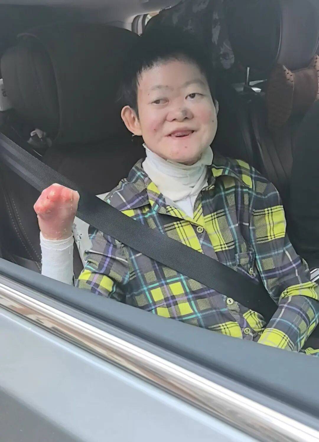 医生断言“活不过2岁”的郑州罕见病女孩<strong></p>
<p>零钱包理财</strong>，24岁“带伤出征”，开启西藏之行