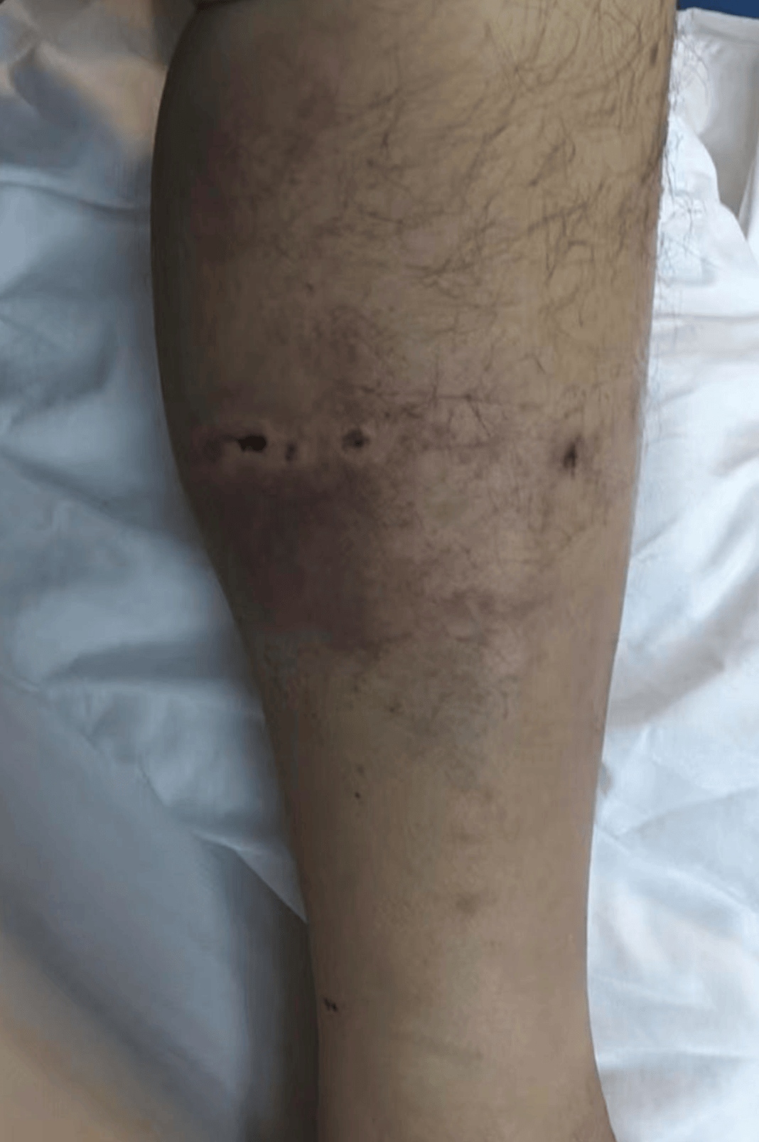 重庆男子上山采菌正面遇黑熊袭击<strong></p>
<p>p2p理财好</strong>，当事人：小腿被咬，穿的水鞋救了我一命；遭一掌打下山坡后险坠山崖幸被树枝拦住，醒后找到手机求救