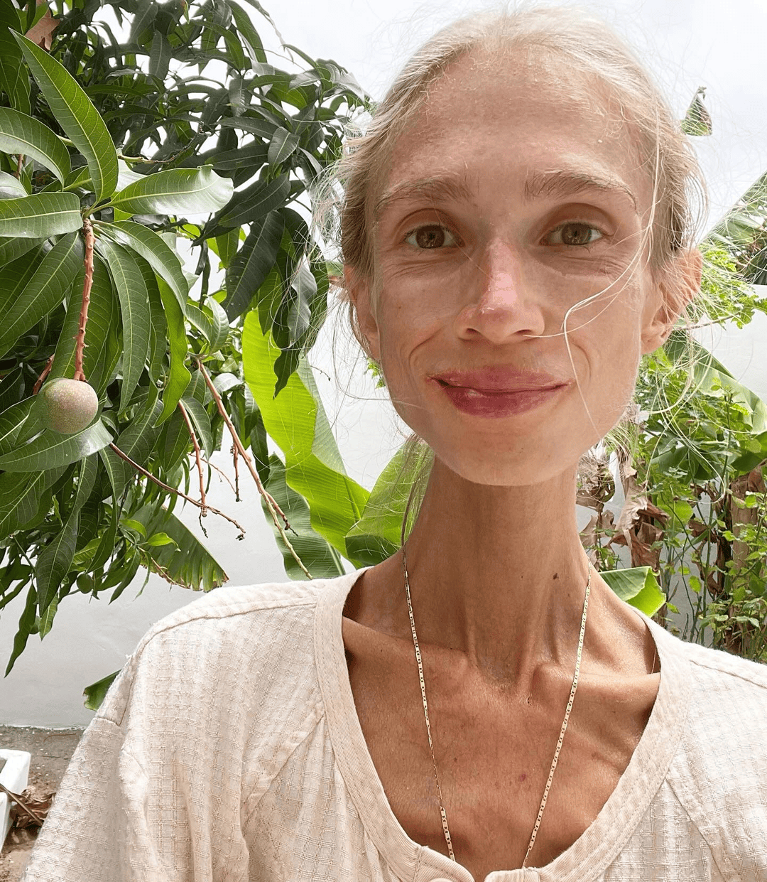 坚持只吃水果8年<strong></p>
<p>理财风险</strong>,27岁波兰女子巴厘岛酒店去世:体重仅22公斤,指甲变黄牙齿腐烂