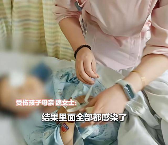 江西一5岁男孩在幼儿园被戳伤致左眼失明<strong></p>
<p>p2p网贷理财</strong>,家长称老师用猪油涂抹试图消肿