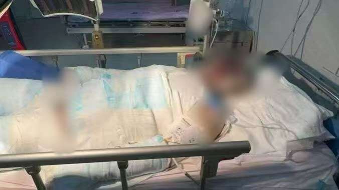 父子在哈尔滨一亲戚公司上班遇爆炸全身烧伤<strong></p>
<p>公募理财</strong>,治疗花费近百万公司拒赔偿?亲戚回应