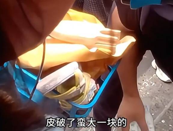 看着都疼<strong></p>
<p>哪家银行理财产品</strong>!上海街头一男子突然求助:10岁女儿被死死卡住!这个行为太危险→