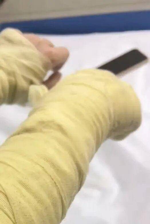 湖南一女主播被伪装的包裹炸伤<strong></p>
<p>哪家银行理财产品</strong>，永州公安：正在核实具体情况