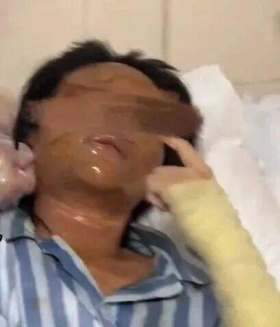 湖南一女主播被伪装的包裹炸伤<strong></p>
<p>哪家银行理财产品</strong>，永州公安：正在核实具体情况