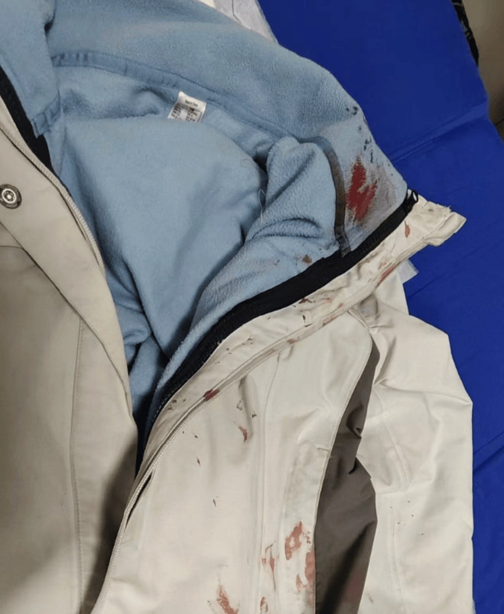 河南一男子街头挥刀乱刺，被休假女警一脚踢落凶器！女警面部缝合30余针，手套被血浸透