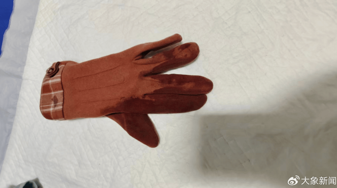 河南一男子街头挥刀乱刺<strong></p>
<p>保本保息理财产品</strong>,被休假女警一脚踢落凶器!女警面部缝合30余针,手套被血浸透