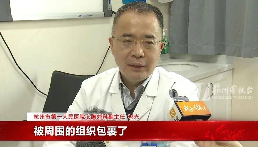 17岁小伙参军体检发现胸腔内有根5cm缝衣针<strong></p>
<p>互联网投资理财</strong>,父母回忆或是1岁时扎入,取出时已锈迹斑斑